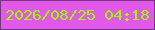文字の大きさ：4、枠の色：74367f、背景の色：e258e9、文字の色：9efa01 無料ブログパーツのブログ時計