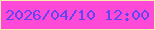文字の大きさ：5、枠の色：f5efae、背景の色：ff4ad8、文字の色：6345f0 無料ブログパーツのブログ時計